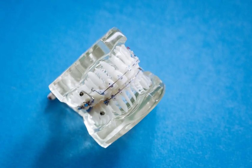 Модель зубов стоматологический