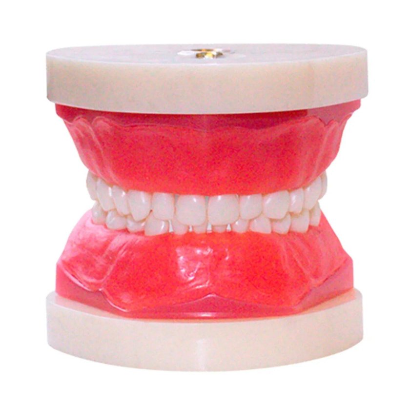 Аппарат в сменном прикусе