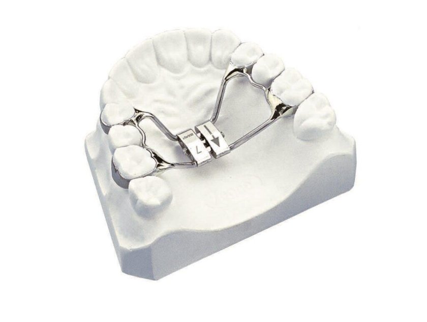 Аппарат дерихсвайлера ортодонтия