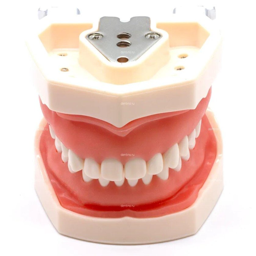 Стоматологическая шина для челюсти