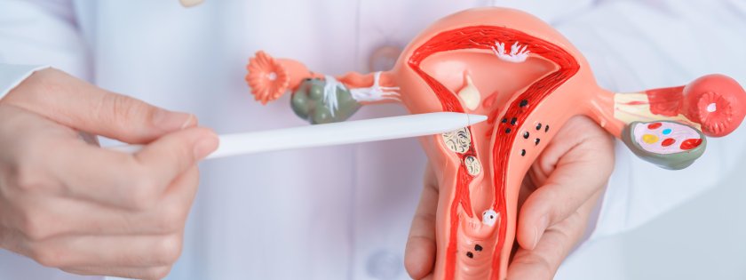 Woman Pain Art Cancer cervix