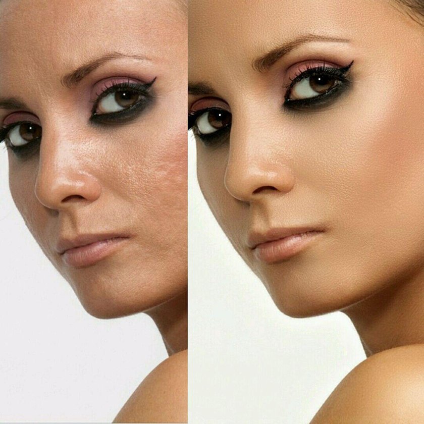 Ретуширование фотографий