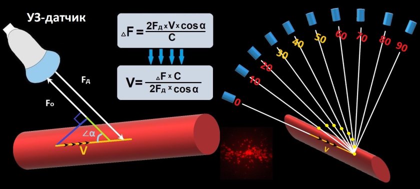 Эффект Доплера в УЗИ сосудов