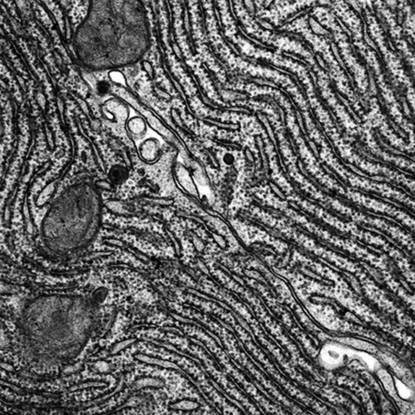 Гранулярная ЭПС Электронограмма