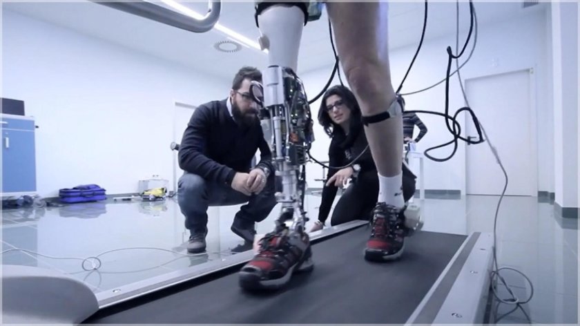 Бионический протез Bionic