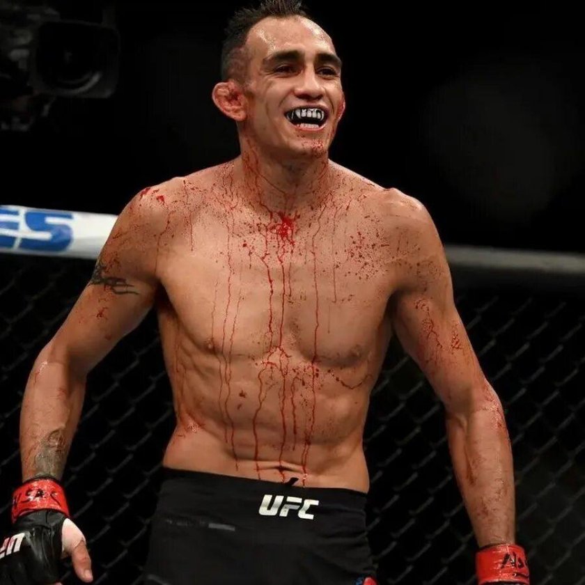 Боец ММА Тони Фергюсон