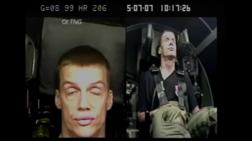 Лицо при перегрузке